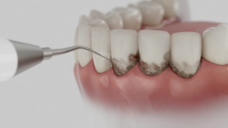 Trusted Dental Crowns And Bridges service in Ada, OH - Dentist Open Now